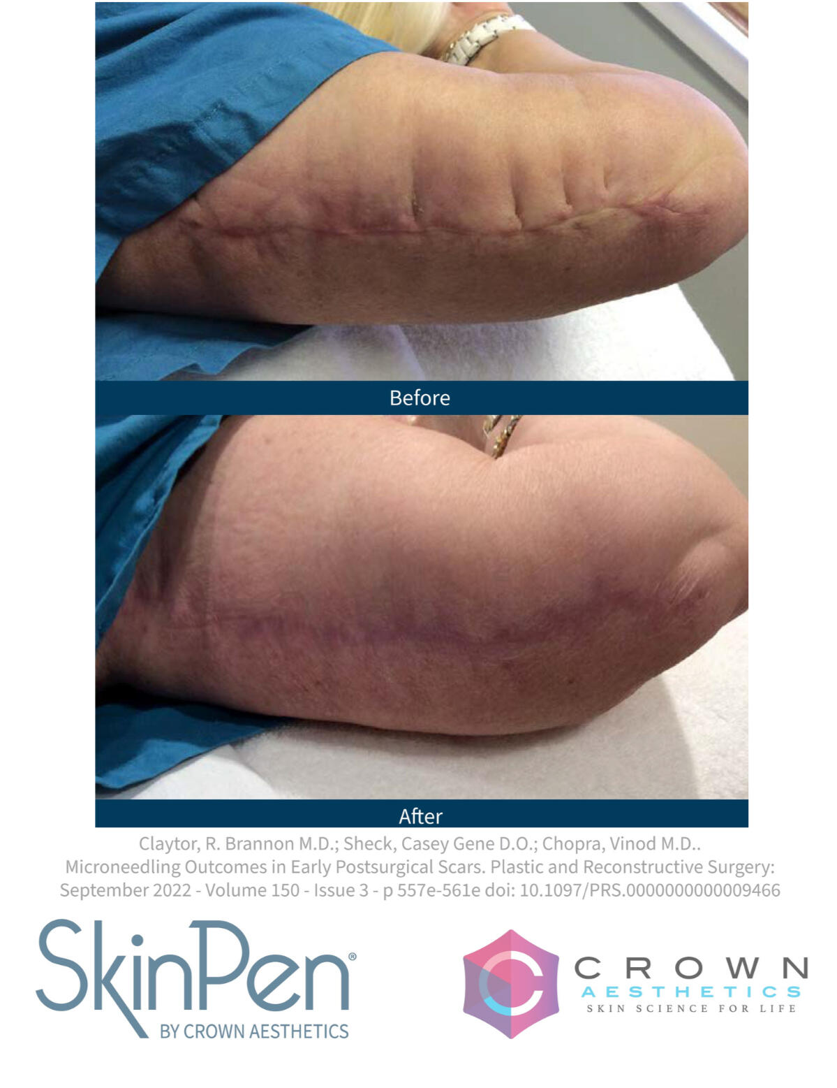 Fine Lines & Wrinkles